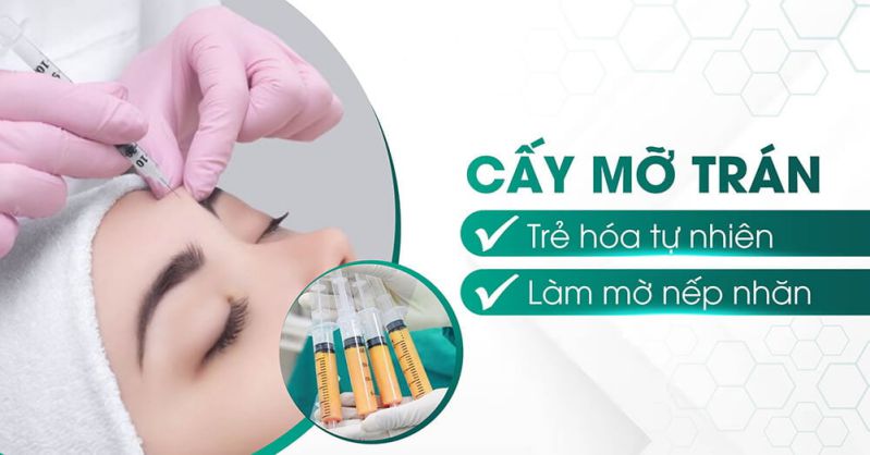 Làm đầy trán bằng mỡ tự thân