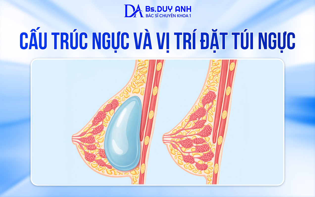 Cấu trúc ngực và vị trí đặt túi ngực