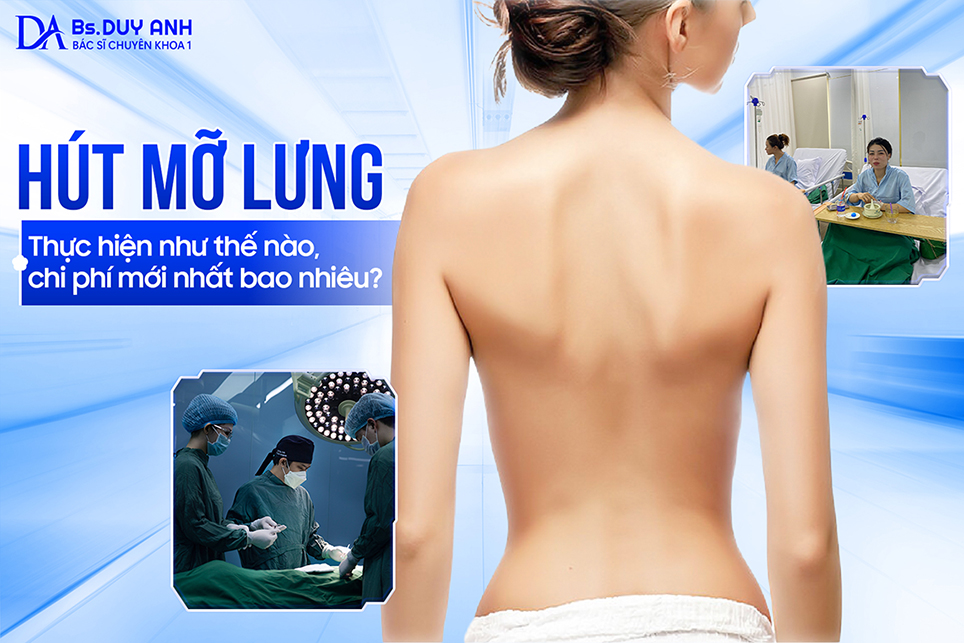 Hút Mỡ Lưng: Thực Hiện Như Thế Nào, Chi Phí Mới Nhất Bao Nhiêu?