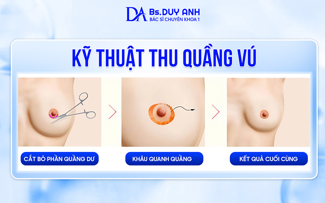 Kỹ thuật thu quầng vú