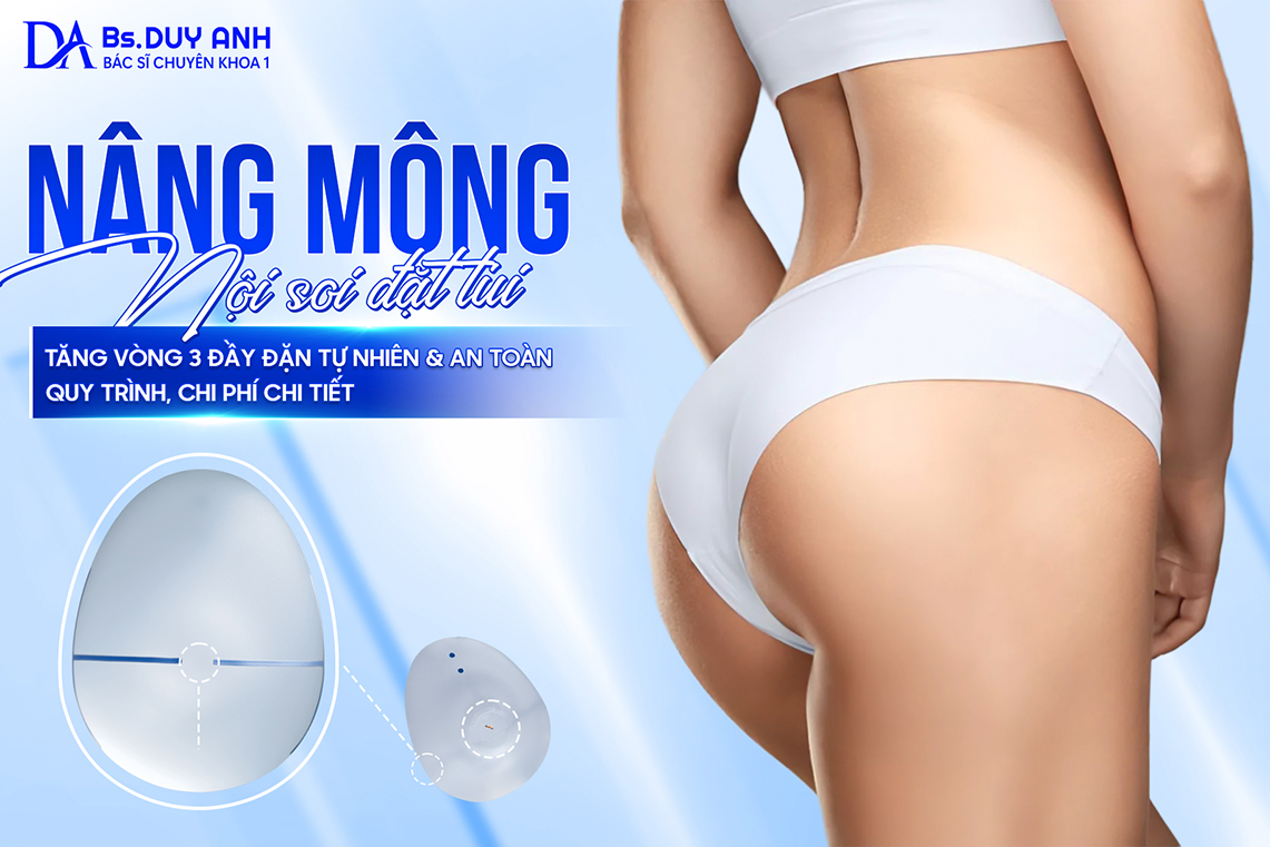 Nâng Mông Nội Soi Đặt Túi: Tăng Vòng 3 Đầy Đặn, Tự Nhiên & An Toàn – Quy Trình, Chi Phí Chi Tiết