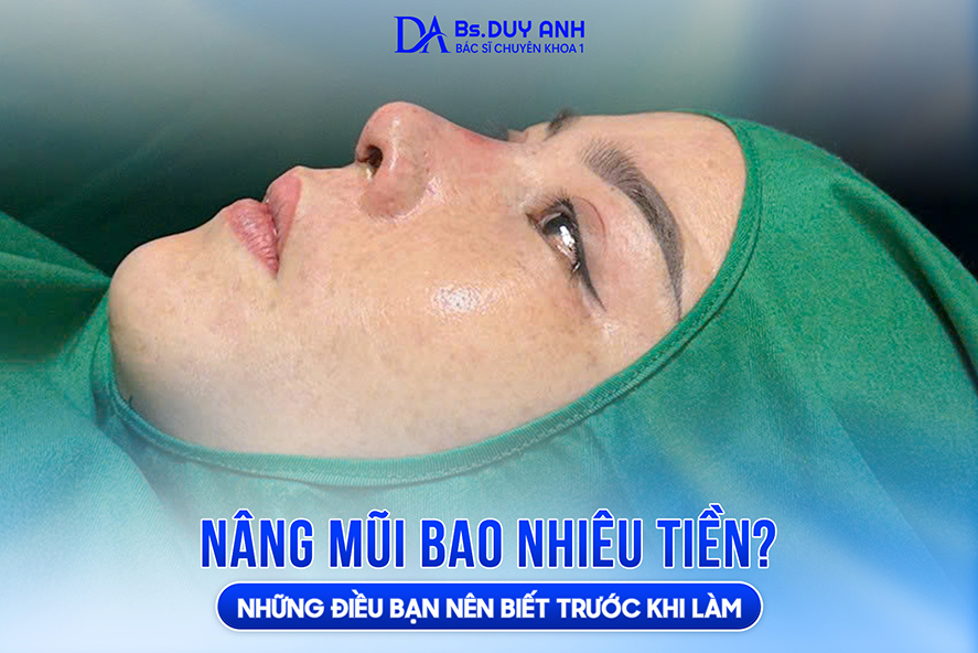 Nâng mũi bao nhiêu tiền? Những điều bạn nên biết trước khi làm