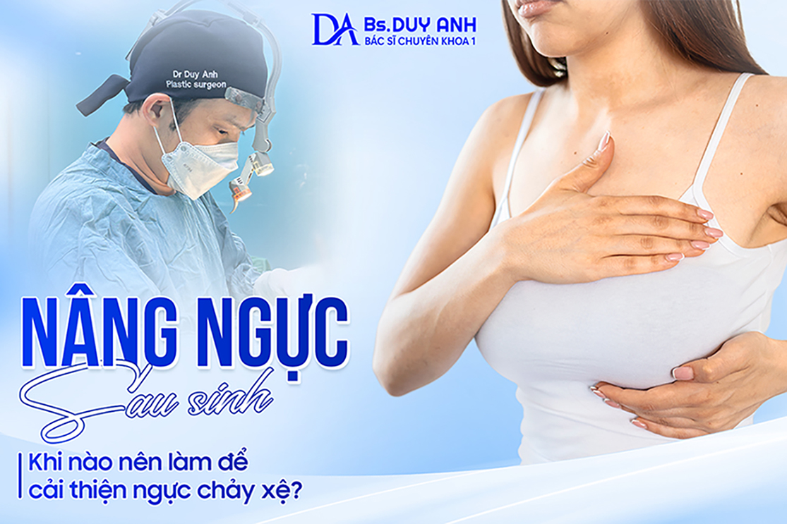 Nâng ngực sau sinh: Khi nào nên làm để cải thiện ngực chảy xệ?