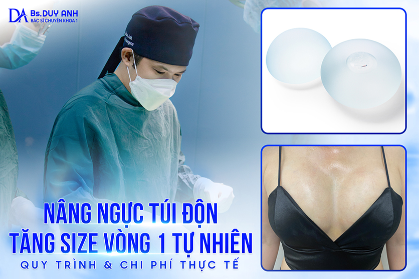 Nâng Ngực Túi Độn: Tăng Size Vòng 1 Tự Nhiên – Quy Trình & Chi Phí Thực Tế 