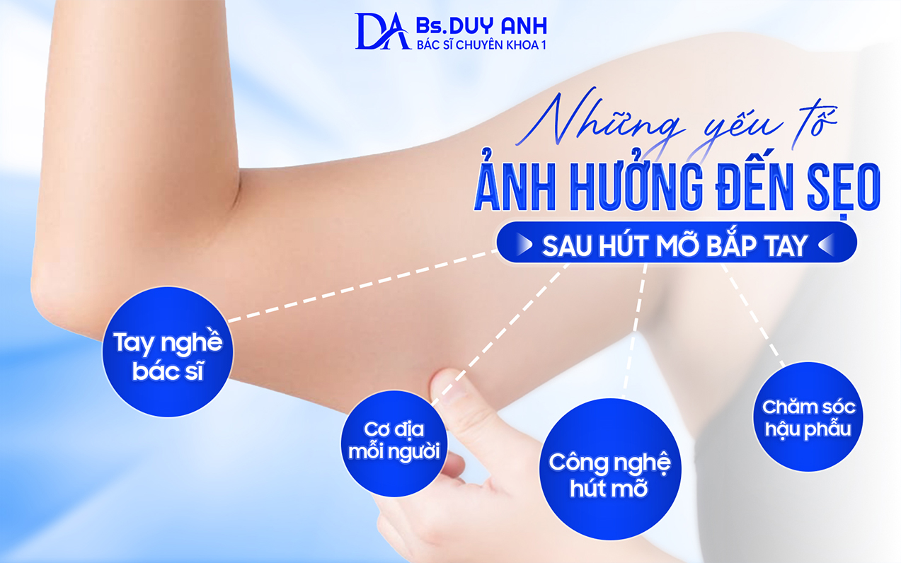 Những yếu tố ảnh hưởng đến sẹo sau hút mỡ bắp tay