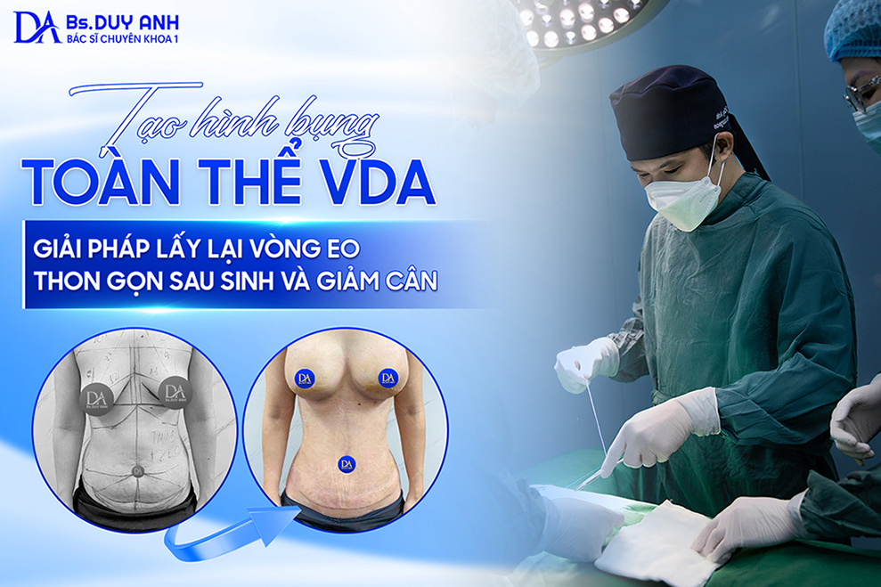 Tạo Hình Bụng VDA – Giải Pháp Lấy Lại Vòng Eo Thon Gọn Sau Sinh Và Giảm Cân