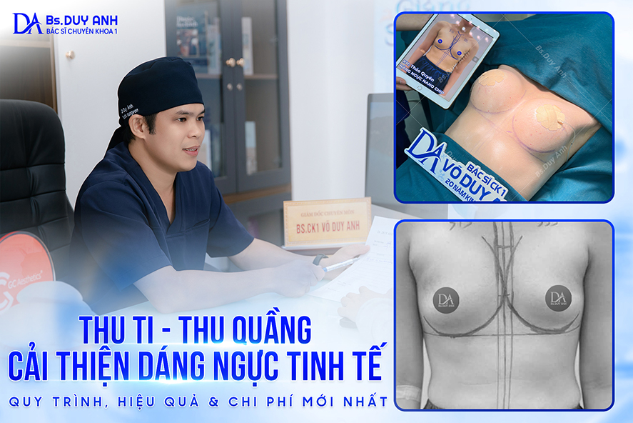 Thu Ti – Thu Quầng: Cải Thiện Dáng Ngực Tinh Tế – Quy Trình, Hiệu Quả & Chi Phí Mới Nhất