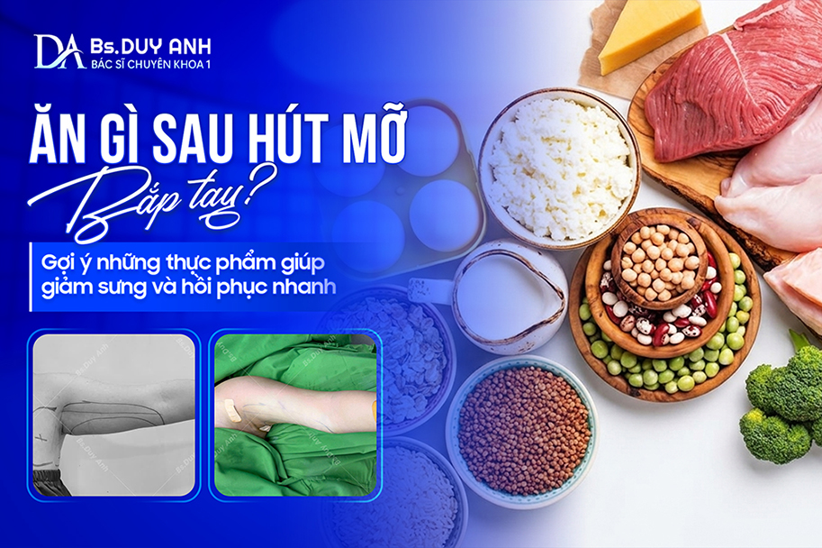 Ăn Gì Sau Hút Mỡ Bắp Tay? Gợi Ý Những Thực Phẩm Giúp Giảm Sưng Và Hồi Phục Nhanh