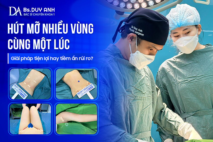 Hút Mỡ Nhiều Vùng Cùng Một Lúc: Giải Pháp Tiện Lợi Hay Tiềm Ẩn Rủi Ro? 