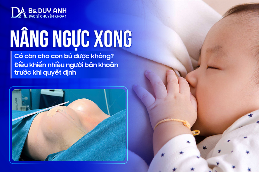 Nâng Ngực Xong Có Còn Cho Con Bú Được Không? Điều Khiến Nhiều Người Băn Khoăn Trước Khi Quyết Định