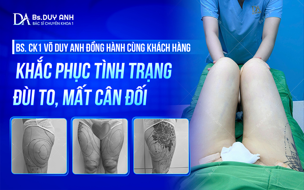 BS. CK1 Võ Duy Anh đồng hành cùng khách hàng trên hành trình sở hữu vóc dáng tự tin