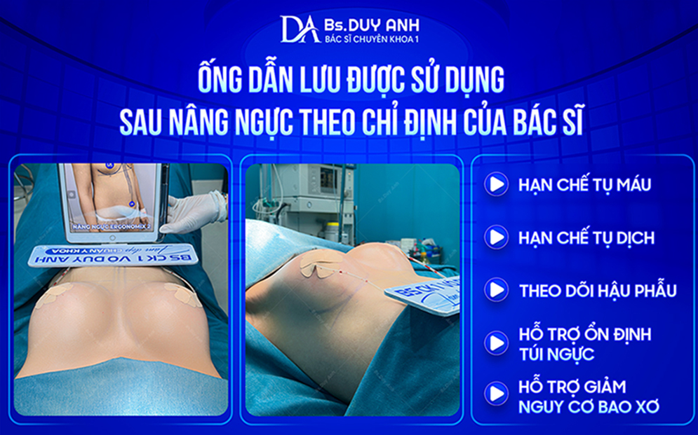 Ống dẫn lưu giúp hỗ trợ theo dõi và kiểm soát quá trình hồi phục sau phẫu thuật