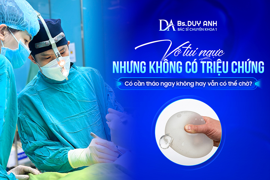 Vỡ Túi Ngực Nhưng Không Có Triệu Chứng: Có Cần Tháo Ngay Không Hay Vẫn Có Thể Chờ?