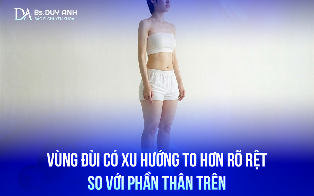 Vùng đùi phát triển nhiều hơn so với khung thân trên, làm tỷ lệ cơ thể mất cân đối