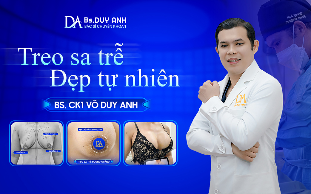 Giải pháp treo sa trễ an toàn cùng Bs. CK1 Võ Duy Anh
