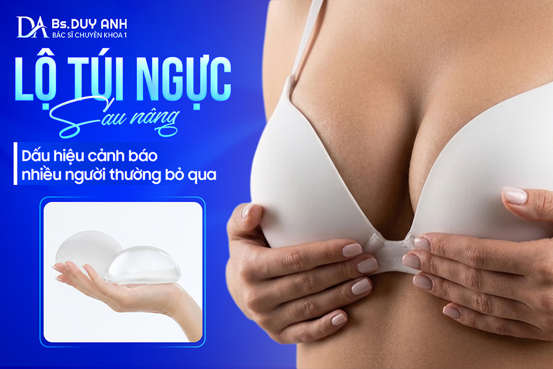 Lộ Túi Ngực Sau Nâng: Dấu Hiệu Cảnh Báo Nhiều Người Thường Bỏ Qua