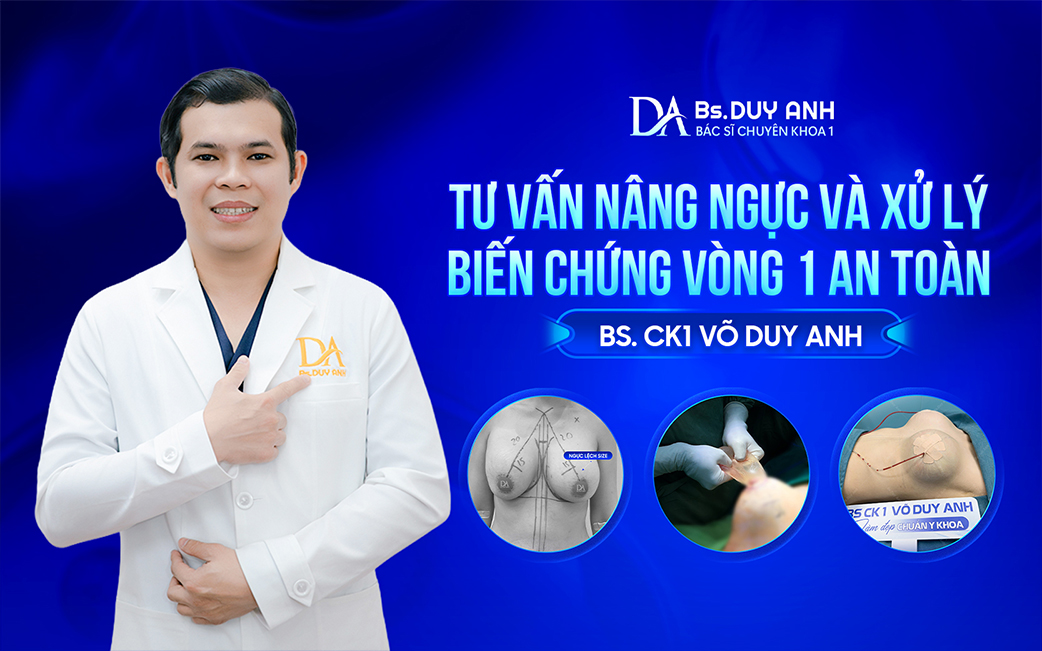 Nâng ngực an toàn – Giải pháp xử lý biến chứng hiệu quả cùng Bs. CK1 Võ Duy Anh