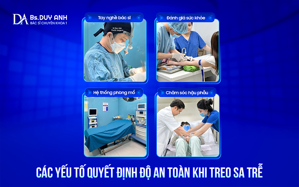 Những yếu tố ảnh hưởng đến độ an toàn khi treo sa trễ