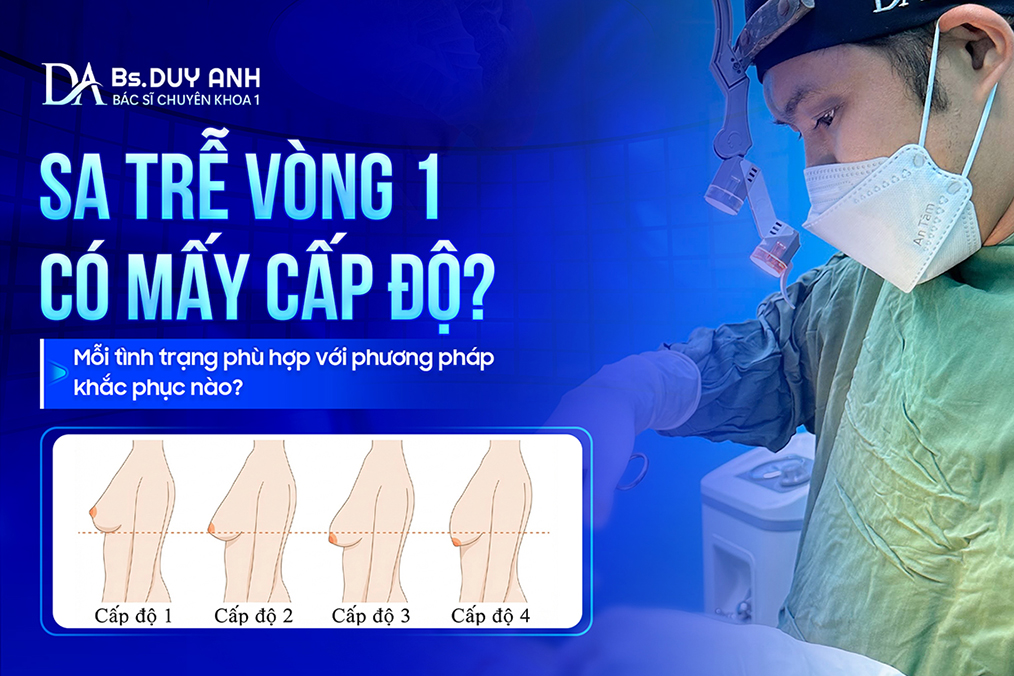 Sa Trễ Vòng 1 Có Mấy Cấp Độ? Mỗi Tình Trạng Phù Hợp Với Phương Pháp Khắc Phục Nào?