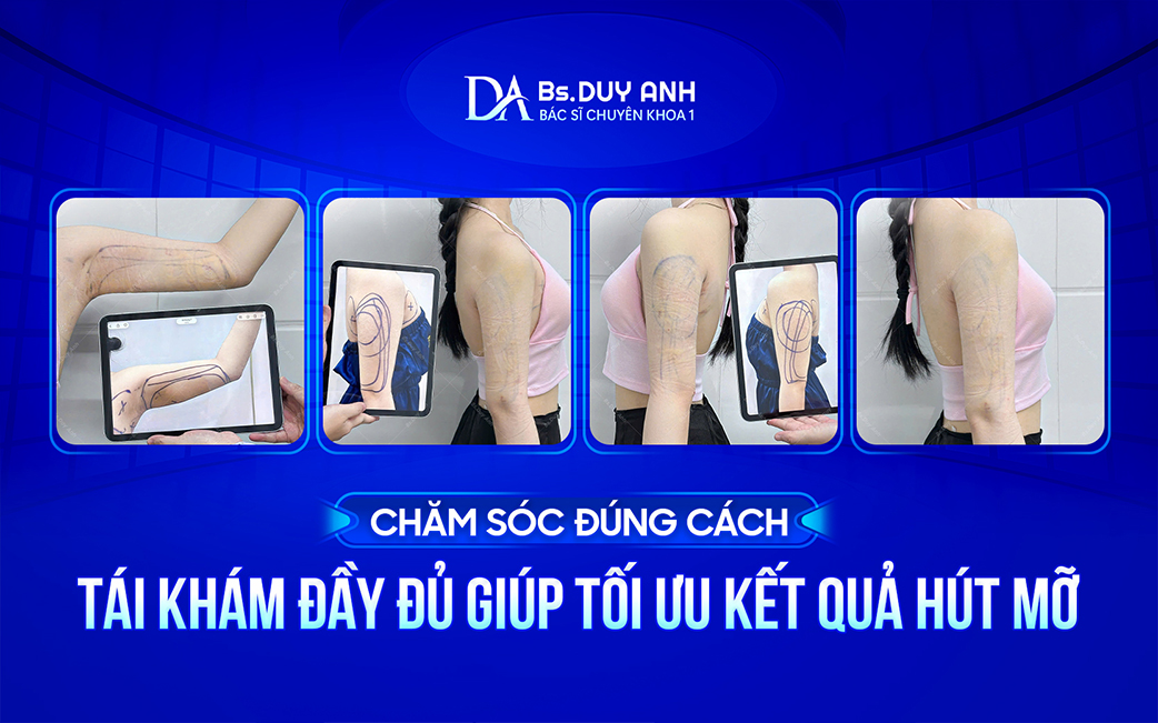 Tái khám đúng lịch giúp theo dõi quá trình co hồi của da