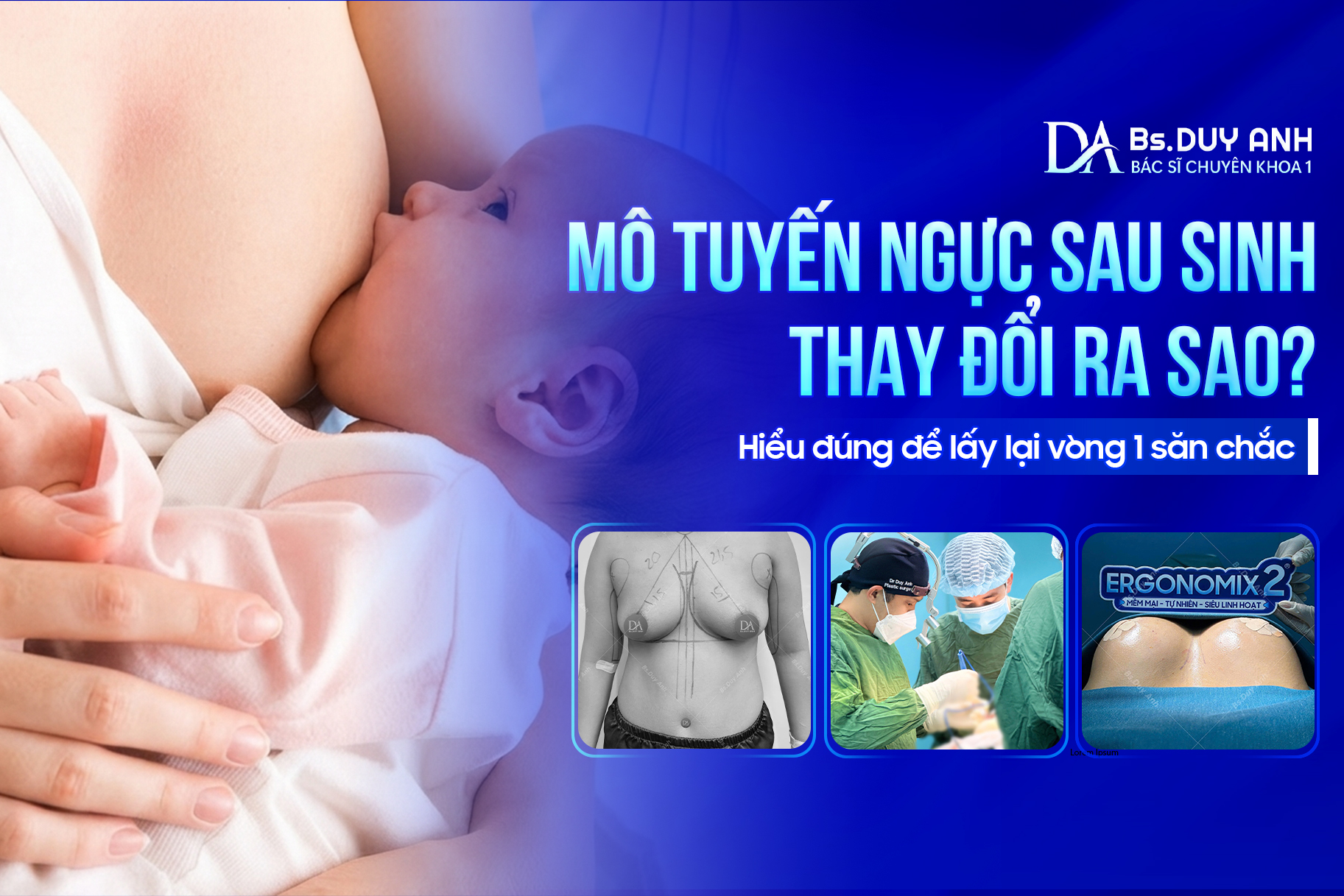 Mô Tuyến Ngực Sau Sinh Thay Đổi Ra Sao? Hiểu Đúng Để Lấy Lại Vòng 1 Săn Chắc