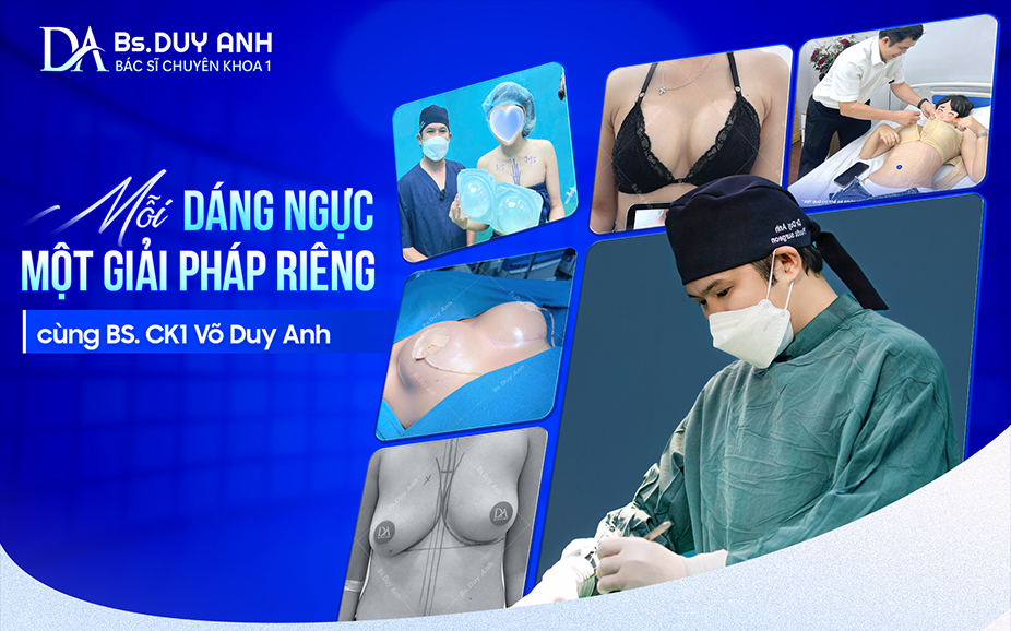 Nâng ngực an toàn, lựa chọn túi ngực phù hợp cùng BS. CK1 Võ Duy Anh