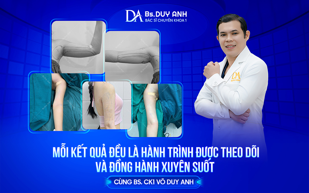 Từ ca phẫu thuật đến những lần tái khám, BS. CK1 Võ Duy Anh luôn theo sát từng khách hàng