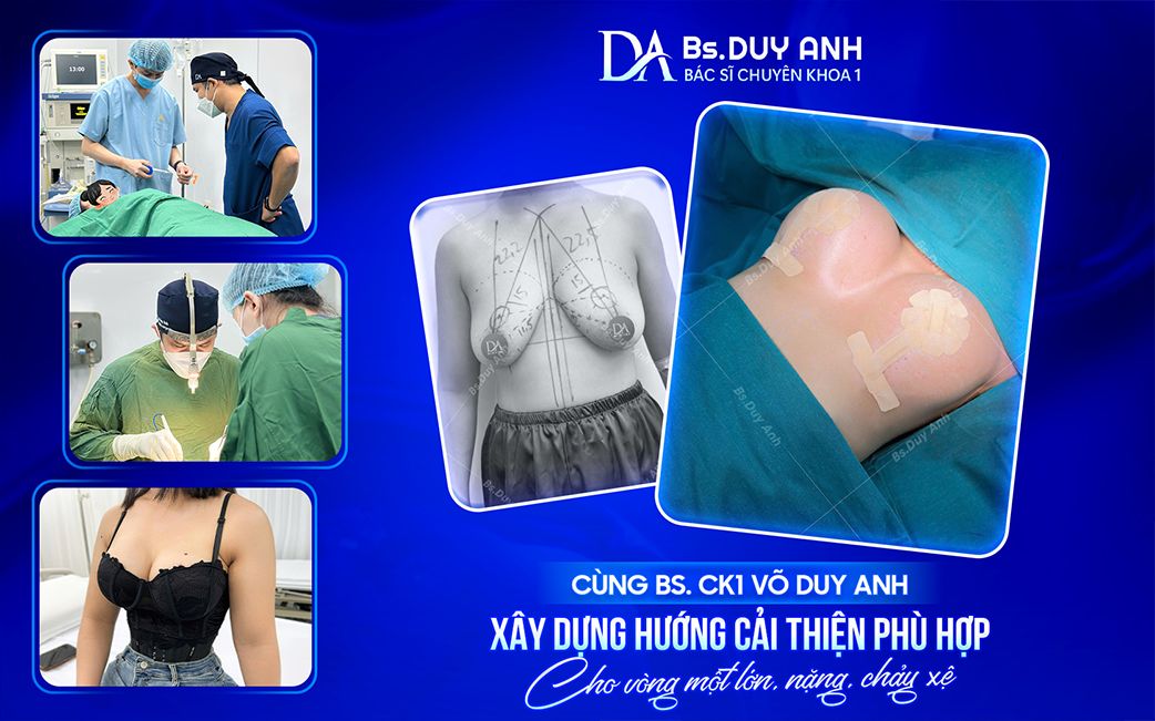 Đồng hành cùng BS. CK1 Võ Duy Anh trong hành trình cải thiện vòng một lớn, nặng, chảy xệ