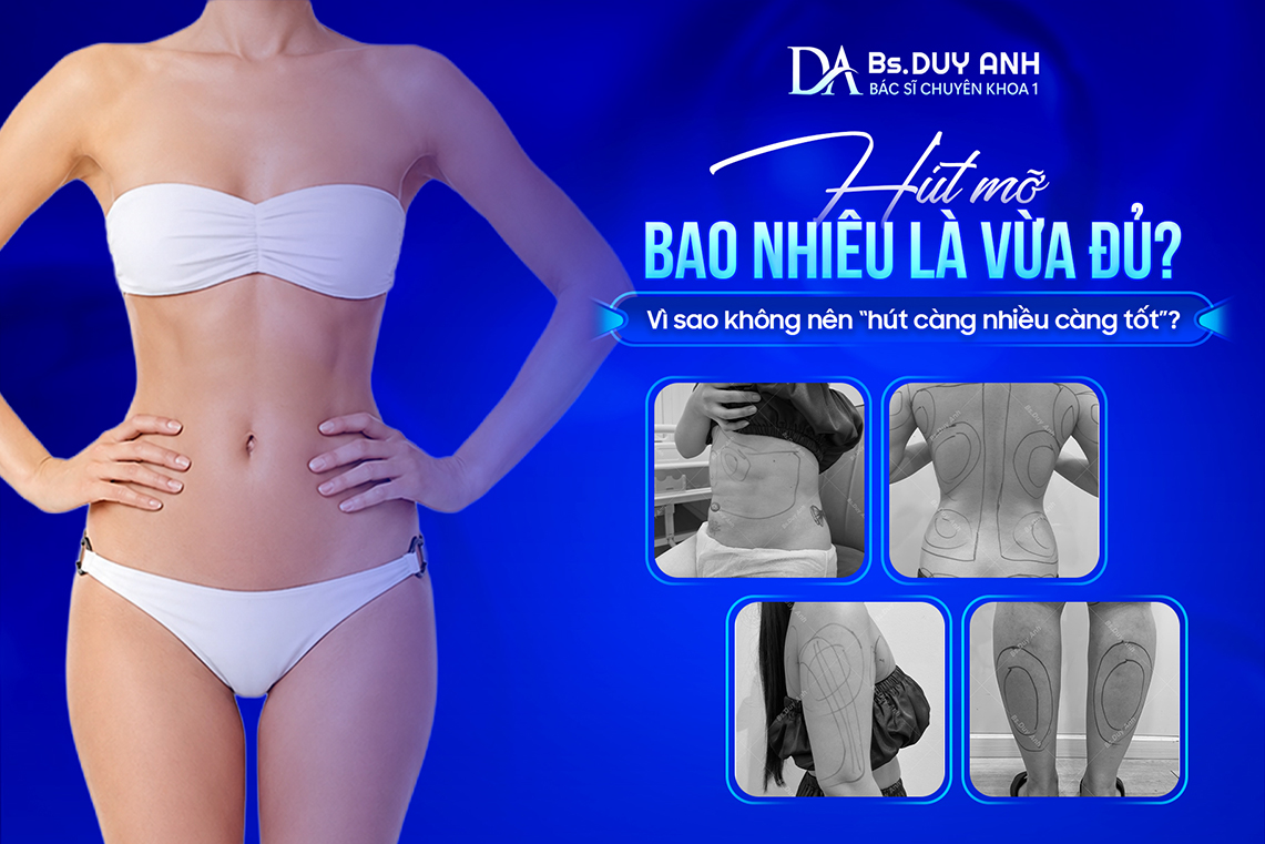 Hút Mỡ Bao Nhiêu Là Vừa Đủ? Vì Sao Không Nên “Hút Càng Nhiều Càng Tốt”?