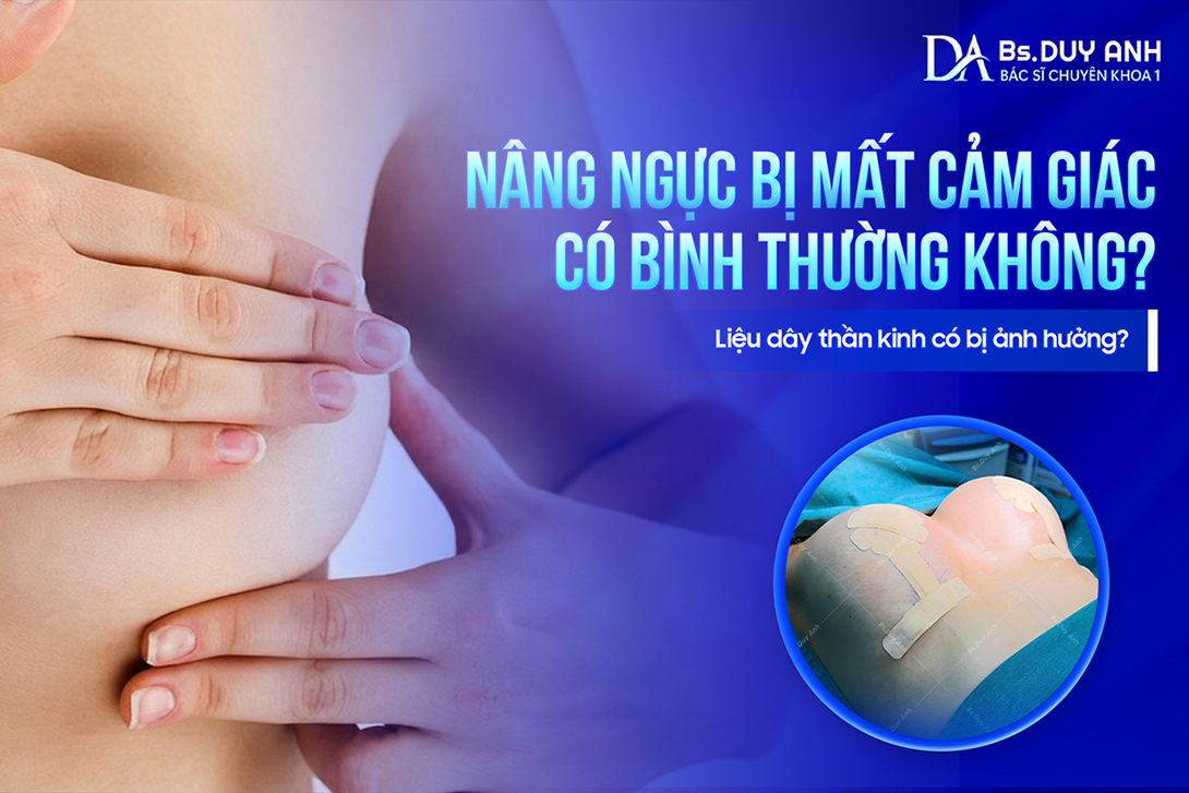 Nâng Ngực Bị Mất Cảm Giác Có Bình Thường Không? Liệu Dây Thần Kinh Có Bị Ảnh Hưởng?