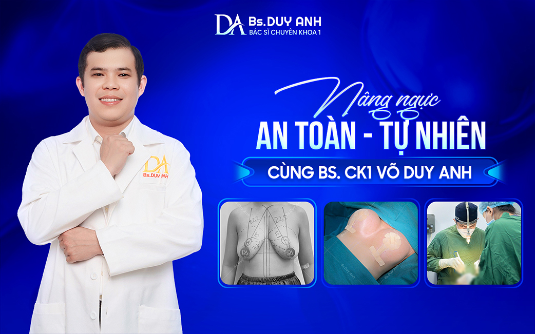 Nâng ngực cùng BS. CK1 Võ Duy Anh với định hướng an toàn và phù hợp