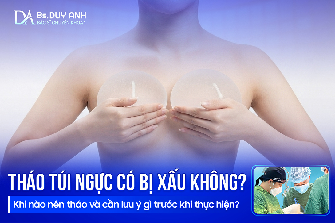 Tháo Túi Ngực Có Bị Xấu Không? Khi Nào Nên Tháo Và Cần Lưu Ý Gì Trước Khi Thực Hiện? 