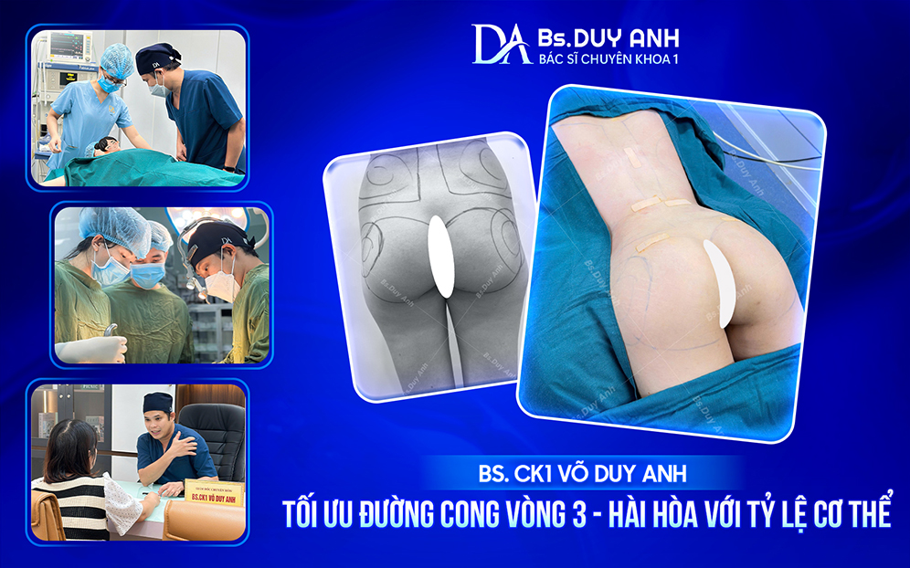 An tâm nâng mông cùng BS. CK1 Võ Duy Anh – Chú trọng an toàn trong từng bước