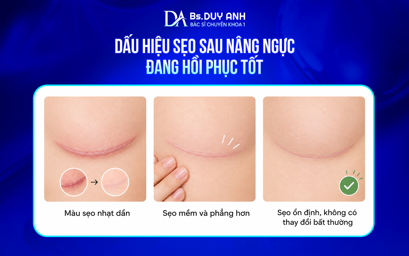 Các dấu hiệu cho thấy quá trình lành sẹo sau nâng ngực diễn ra tốt