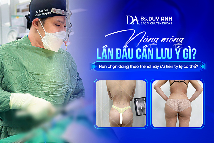 Nâng Mông Lần Đầu Cần Lưu Ý Gì? Nên Chọn Dáng Theo Trend Hay Ưu Tiên Tỷ Lệ Cơ Thể?