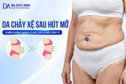 Da Chảy Xệ Sau Hút Mỡ: Biến Chứng Đáng Lo Hay Chỉ Là Hiểu Lầm?