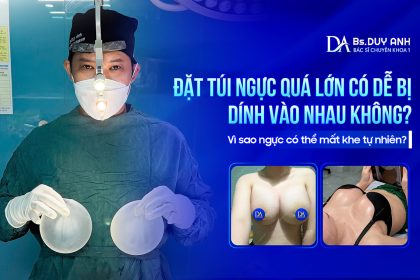 Đặt Túi Ngực Quá Lớn Có Dễ Bị Dính Vào Nhau Không? Vì Sao Ngực Có Thể Mất Khe Tự Nhiên?