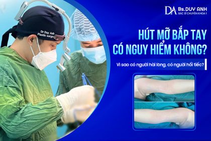Hút Mỡ Bắp Tay Có Nguy Hiểm Không? Vì Sao Có Người Hài Lòng, Có Người Hối Tiếc?