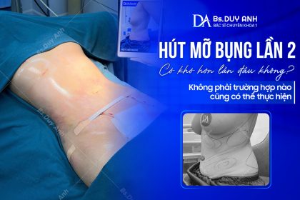 Hút Mỡ Bụng Lần 2 Có Khó Hơn Lần Đầu Không? Không Phải Trường Hợp Nào Cũng Có Thể Thực Hiện