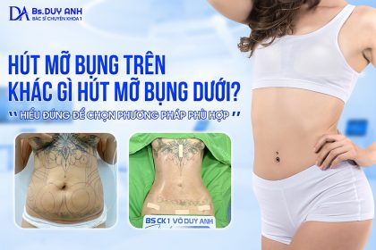 Hút mỡ bụng trên khác gì hút mỡ bụng dưới? Hiểu đúng để chọn phương pháp phù hợp