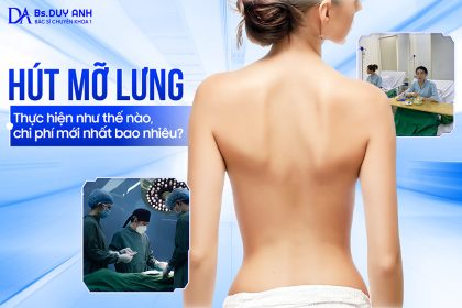 Hút Mỡ Lưng: Thực Hiện Như Thế Nào, Chi Phí Mới Nhất Bao Nhiêu?