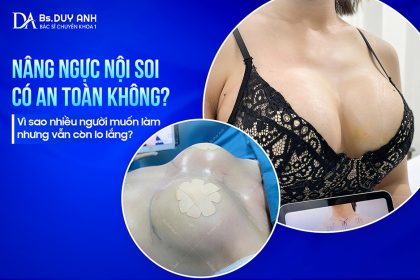 Nâng Ngực Nội Soi Có An Toàn Không? Vì Sao Nhiều Người Muốn Làm Nhưng Vẫn Còn Lo Lắng?