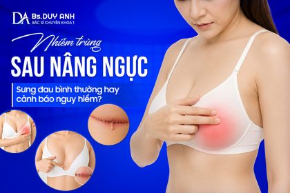 Nhiễm Trùng Sau Nâng Ngực: Sưng Đau Bình Thường Hay Cảnh Báo Nguy Hiểm?