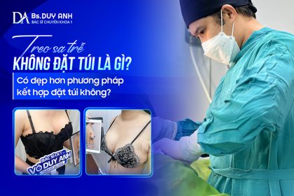 Treo Sa Trễ Không Đặt Túi Là Gì? Có Đẹp Hơn Phương Pháp Kết Hợp Đặt Túi Không?