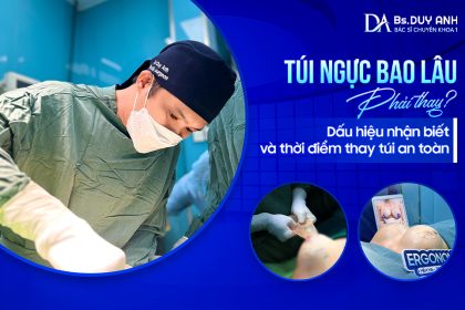 Túi Ngực Bao Lâu Phải Thay? Dấu Hiệu Nhận Biết Và Thời Điểm Thay Túi An Toàn 